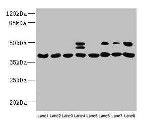 HIF1AN Antibody - Western blot All lanes: HIF1AN antibody at 12µg/ml Lane 1: Mouse heart tissue Lane 2: Mouse skeletal muscle tissue Lane 3: K562 whole cell lysate Lane 4: MCF-7 whole cell lysate Lane 5: HL60 whole cell lysate Lane 6: 293T whole cell lysate Lane 7: Jurkat whole cell lysate Lane 8: A375 whole cell lysate Secondary Goat polyclonal to rabbit IgG at 1/10000 dilution Predicted band size: 41 kDa Observed band size: 41, 48 kDa