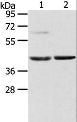 HIF1AN Antibody - Western blot analysis of Mouse brain and liver tissue, using HIF1AN Polyclonal Antibody at dilution of 1:200.