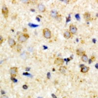 HIF1AN Antibody - Immunohistochemical analysis of FIH-1 staining in rat brain formalin fixed paraffin embedded tissue section. The section was pre-treated using heat mediated antigen retrieval with sodium citrate buffer (pH 6.0). The section was then incubated with the antibody at room temperature and detected using an HRP conjugated compact polymer system. DAB was used as the chromogen. The section was then counterstained with hematoxylin and mounted with DPX.