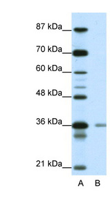 HIF1AN Antibody - HIF1AN antibody Western blot of Jurkat lysate. This image was taken for the unconjugated form of this product. Other forms have not been tested.