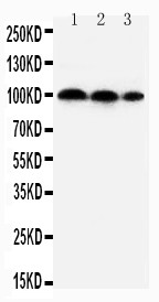 HIF2A / EPAS1 Antibody - HIF-2-alpha antibody Western blot. Lane 1: HELA Cell Lysate. Lane 2: MCF-7 Cell Lysate. Lane 3: JURKAT Cell Lysate.