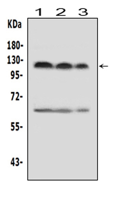 HIF2A / EPAS1 Antibody - Western blot analysis of HIF-2A using anti-HIF-2A antibody. Electrophoresis was performed on a 5-20% SDS-PAGE gel at 70V (Stacking gel) / 90V (Resolving gel) for 2-3 hours. The sample well of each lane was loaded with 50ug of sample under reducing conditions. Lane 1: human MCF-7 whole cell lysates, Lane 2: human Hela whole cell lysates, Lane 3: human Jurkat whole cell lysates, After Electrophoresis, proteins were transferred to a Nitrocellulose membrane at 150mA for 50-90 minutes. Blocked the membrane with 5% Non-fat Milk/ TBS for 1.5 hour at RT. The membrane was incubated with rabbit anti-HIF-2A antigen affinity purified polyclonal antibody at 0.5 µg/mL overnight at 4°C, then washed with TBS-0.1% Tween 3 times with 5 minutes each and probed with a goat anti-rabbit IgG-HRP secondary antibody at a dilution of 1:10000 for 1.5 hour at RT. The signal is developed using an Enhanced Chemiluminescent detection (ECL) kit with Tanon 5200 system. A specific band was detected for HIF-2A at approximately 120KD. The expected band size for HIF-2A is at 96KD.