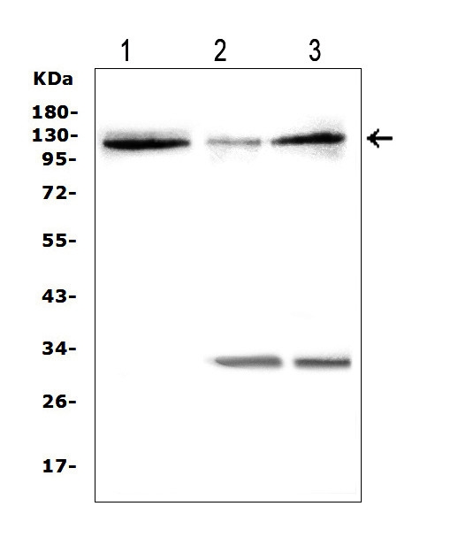 HIF2A / EPAS1 Antibody - Western blot analysis of HIF-2A using anti-HIF-2A antibody. Electrophoresis was performed on a 5-20% SDS-PAGE gel at 70V (Stacking gel) / 90V (Resolving gel) for 2-3 hours. The sample well of each lane was loaded with 50ug of sample under reducing conditions. Lane 1: rat brain tissue lysates, Lane 2: rat RH35 whole cell lysates, Lane 3: rat small intestine tissue lysates, After Electrophoresis, proteins were transferred to a Nitrocellulose membrane at 150mA for 50-90 minutes. Blocked the membrane with 5% Non-fat Milk/ TBS for 1.5 hour at RT. The membrane was incubated with rabbit anti-HIF-2A antigen affinity purified polyclonal antibody at 0.5 µg/mL overnight at 4°C, then washed with TBS-0.1% Tween 3 times with 5 minutes each and probed with a goat anti-rabbit IgG-HRP secondary antibody at a dilution of 1:10000 for 1.5 hour at RT. The signal is developed using an Enhanced Chemiluminescent detection (ECL) kit with Tanon 5200 system. A specific band was detected for HIF-2A at approximately 120KD. The expected band size for HIF-2A is at 96KD.