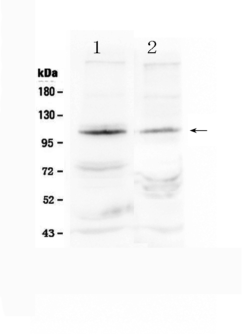 HIF2A / EPAS1 Antibody - Western blot analysis of HIF2A using anti-HIF2A antibody. Electrophoresis was performed on a 5-20% SDS-PAGE gel at 70V (Stacking gel) / 90V (Resolving gel) for 2-3 hours. The sample well of each lane was loaded with 50ug of sample under reducing conditions. Lane 1: rat thymus tissue lysates, Lane 2: rat testis tissue lysates, After Electrophoresis, proteins were transferred to a Nitrocellulose membrane at 150mA for 50-90 minutes. Blocked the membrane with 5% Non-fat Milk/ TBS for 1.5 hour at RT. The membrane was incubated with rabbit anti-HIF2A antigen affinity purified polyclonal antibody at 0.5 µg/mL overnight at 4°C, then washed with TBS-0.1% Tween 3 times with 5 minutes each and probed with a goat anti-rabbit IgG-HRP secondary antibody at a dilution of 1:10000 for 1.5 hour at RT. The signal is developed using an Enhanced Chemiluminescent detection (ECL) kit with Tanon 5200 system. A specific band was detected for HIF2A at approximately 110-120KD. The expected band size for HIF2A is at 96KD.