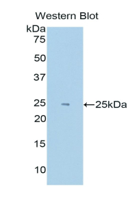 HIF2A / EPAS1 Antibody - Western blot of recombinant HIF2A / EPAS1.  This image was taken for the unconjugated form of this product. Other forms have not been tested.