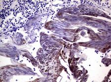 HIF2A / EPAS1 Antibody - Immunohistochemical staining of paraffin-embedded Human lymph node tissue within the normal limits using anti-EPAS1 mouse monoclonal antibody.
