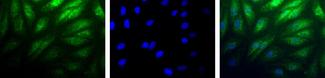 HIF2A / EPAS1 Antibody - Hif-2 alpha immunoreactivity in human cardiac myocytes stained .  This image was taken for the unconjugated form of this product. Other forms have not been tested.