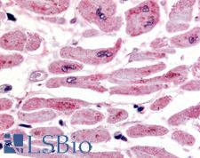 HIF2A / EPAS1 Antibody - Anti-HIF2A antibody IHC of human heart. Immunohistochemistry of formalin-fixed, paraffin-embedded tissue after heat-induced antigen retrieval. Antibody concentration 20 ug/ml.  This image was taken for the unconjugated form of this product. Other forms have not been tested.