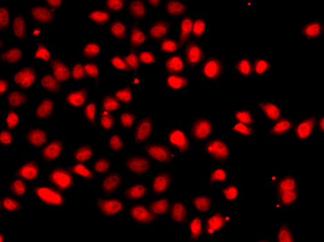 HIF2A / EPAS1 Antibody - Immunofluorescence analysis of A549 cells.