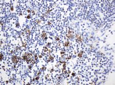 HIF3A / HIF3-Alpha Antibody - IHC of paraffin-embedded Human lymph node tissue using anti-HIF3A mouse monoclonal antibody.