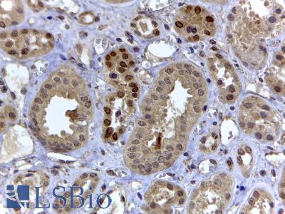 HIF3A / HIF3-Alpha Antibody - HIF3A antibody-D2 (4 ug/ml) staining of paraffin embedded Human Kidney. Steamed antigen retrieval with citrate buffer pH 6, HRP-staining.