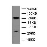 HIF3A / HIF3-Alpha Antibody - WB of HIF3A / HIF3-Alpha antibody. WB: Rat Brain Tissue Lysate.