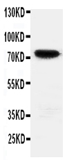 HIF3A / HIF3-Alpha Antibody - Anti-HIF3 antibody, Western blottingWB: Rat Brain Tissue Lysate