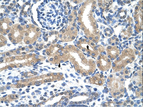 HIF3A / HIF3-Alpha Antibody - HIF3A antibody ARP39936_T100-NP_690007-HIF3A (hypoxia inducible factor 3, alpha subunit) Antibody was used in IHC to stain formalin-fixed, paraffin-embedded human kidney.  This image was taken for the unconjugated form of this product. Other forms have not been tested.