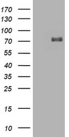 HIF3A / HIF3-Alpha Antibody - HEK293T cells were transfected with the pCMV6-ENTRY control (Left lane) or pCMV6-ENTRY HIF3A (Right lane) cDNA for 48 hrs and lysed. Equivalent amounts of cell lysates (5 ug per lane) were separated by SDS-PAGE and immunoblotted with anti-HIF3A.