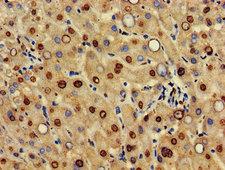 HIF3A / HIF3-Alpha Antibody - Immunohistochemistry Dilution at 1:500 and staining in paraffin-embedded human liver tissue performed on a Leica BondTM system. After dewaxing and hydration, antigen retrieval was mediated by high pressure in a citrate buffer (pH 6.0). Section was blocked with 10% normal Goat serum 30min at RT. Then primary antibody (1% BSA) was incubated at 4°C overnight. The primary is detected by a biotinylated Secondary antibody and visualized using an HRP conjugated SP system.