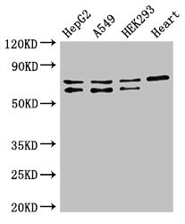 HIF3A / HIF3-Alpha Antibody - Western Blot Positive WB detected in:HepG2 whole cell lysate,A549 whole cell lysate,HEK293 whole cell lysate,Mouse heart tissue All Lanes:HIF3A antibody at 2.5µg/ml Secondary Goat polyclonal to rabbit IgG at 1/50000 dilution Predicted band size: 73,69,40,67,63,65 KDa Observed band size: 73,69 KDa