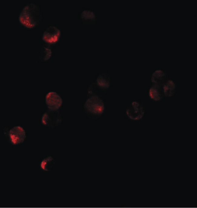 HIGD1A Antibody - Immunofluorescence of HIG1 in 293 cells tissue with HIG1 antibody at 10 ug/ml.