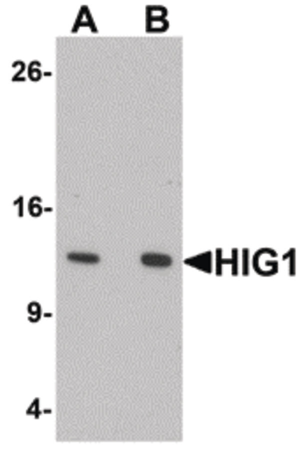 HIGD1A Antibody - Western blot of HIG1 in 293 cell lysate with HIG1 antibody at at (A) 0.5 and (B) 1 ug/ml.