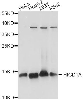 HIGD1A Antibody - Western blot analysis of extracts of various cell lines, using HIGD1A antibody at 1:1000 dilution. The secondary antibody used was an HRP Goat Anti-Rabbit IgG (H+L) at 1:10000 dilution. Lysates were loaded 25ug per lane and 3% nonfat dry milk in TBST was used for blocking. An ECL Kit was used for detection and the exposure time was 1s.