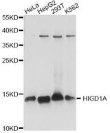 HIGD1A Antibody - Western blot analysis of extracts of various cell lines, using HIGD1A antibody at 1:1000 dilution. The secondary antibody used was an HRP Goat Anti-Rabbit IgG (H+L) at 1:10000 dilution. Lysates were loaded 25ug per lane and 3% nonfat dry milk in TBST was used for blocking. An ECL Kit was used for detection and the exposure time was 1s.