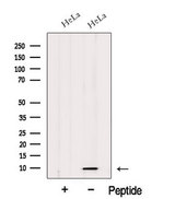 HIGD1A Antibody - Western blot analysis of extracts of HeLa cells using HIGD1A antibody. The lane on the left was treated with blocking peptide.