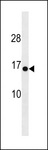 HIGD1C Antibody - HIGD1C Antibody western blot of mouse heart tissue lysates (35 ug/lane). The HIGD1C antibody detected the HIGD1C protein (arrow).