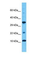 HIGD2A Antibody - Western blot of HIGD2A Antibody with human COLO205 Whole Cell lysate.  This image was taken for the unconjugated form of this product. Other forms have not been tested.