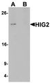 HILPDA / HIG2 Antibody - Western blot analysis of HIG2 in 3T3 cell lysate with HIG2 antibody at 1 ug/ml in (A) the absence and (B) the presence of blocking peptide.