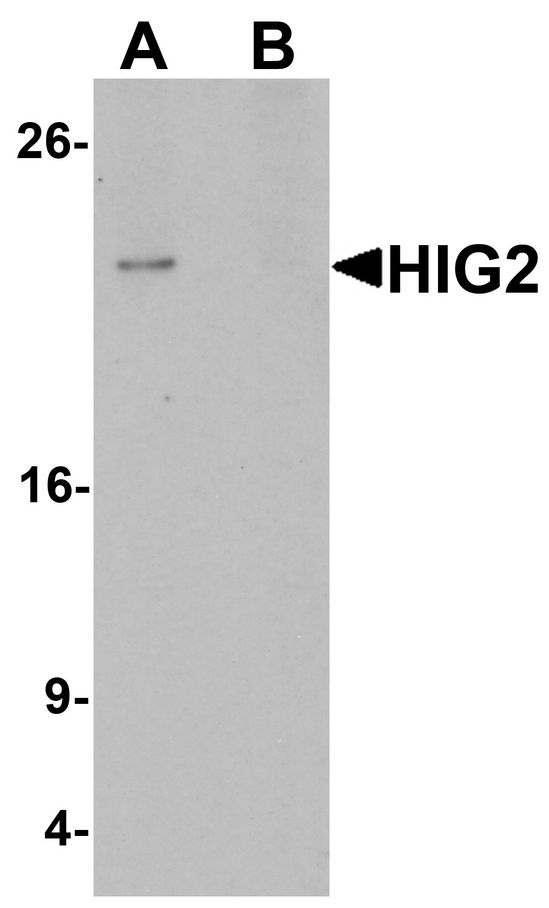 HILPDA / HIG2 Antibody - Western blot analysis of HIG2 in 3T3 cell lysate with HIG2 antibody at 1 ug/ml in (A) the absence and (B) the presence of blocking peptide.