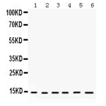 HINT / HINT1 Antibody - HINT1 antibody Western blot. All lanes: Anti HINT1 at 0.5 ug/ml. Lane 1: Rat Liver Tissue Lysate at 50 ug. Lane 2: Rat Thymus Tissue Lysate at 50 ug. Lane 3: Rat Testis Tissue Lysate at 50 ug. Lane 4: Rat Skeletal Muscle Tissue Lysate at 50 ug. Lane 5: HELA Whole Cell Lysate at 40 ug. Lane 6: 22RV1 Whole Cell Lysate at 40 ug. Predicted band size: 14 kD. Observed band size: 14 kD.