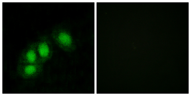 HINT / HINT1 Antibody - Immunofluorescence analysis of HeLa cells, using HINT1 Antibody. The picture on the right is blocked with the synthesized peptide.
