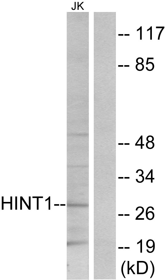 HINT / HINT1 Antibody - Western blot analysis of lysates from Jurkat cells, using HINT1 Antibody. The lane on the right is blocked with the synthesized peptide.