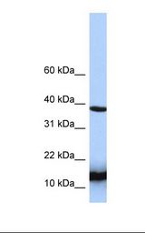 HINT / HINT1 Antibody - Jurkat cell lysate. Antibody concentration: 1.0 ug/ml. Gel concentration: 10-20%.  This image was taken for the unconjugated form of this product. Other forms have not been tested.
