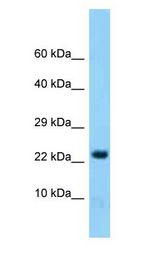 HINT2 Antibody - HINT2 antibody Western Blot of Mouse Brain.  This image was taken for the unconjugated form of this product. Other forms have not been tested.