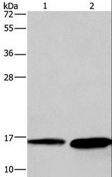 HINT2 Antibody - Western blot analysis of Mouse heart and human hepatocellular carcinoma tissue, using HINT2 Polyclonal Antibody at dilution of 1:300.