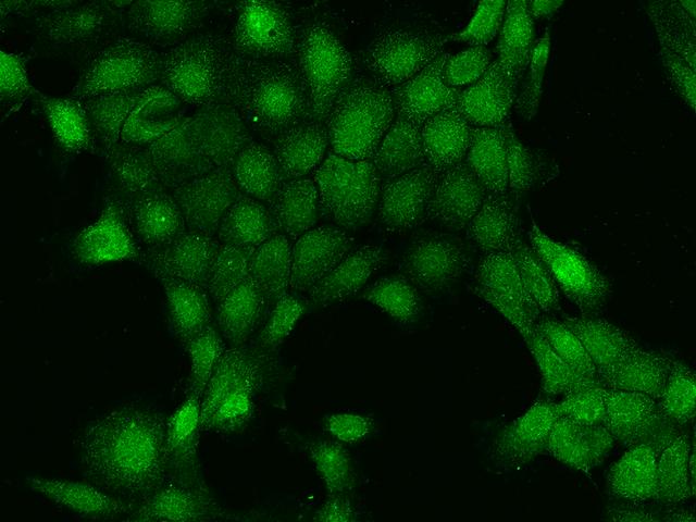 HINT3 Antibody - Immunofluorescence staining of HINT3 in A431 cells. Cells were fixed with 4% PFA, permeabilzed with 0.1% Triton X-100 in PBS, blocked with 10% serum, and incubated with rabbit anti-Human HINT3 polyclonal antibody (dilution ratio 1:200) at 4°C overnight. Then cells were stained with the Alexa Fluor 488-conjugated Goat Anti-rabbit IgG secondary antibody (green). Positive staining was localized to Nucleus and Cytoplasm.