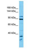 HIP1 Antibody - HIP1 antibody Western Blot of MCF7. Antibody dilution: 1 ug/ml.  This image was taken for the unconjugated form of this product. Other forms have not been tested.