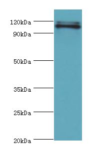 HIP1 Antibody - Western blot. All lanes: HIP1 antibody at 4 ug/ml+A549 whole cell lysate. Secondary antibody: Goat polyclonal to rabbit at 1:10000 dilution. Predicted band size: 116 KDa. Observed band size: 116 kDa.