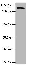 HIP1 Antibody - Western blot All lanes: HIP1 antibody at 4µg/ml + A549 whole cell lysate Secondary Goat polyclonal to rabbit IgG at 1/10000 dilution Predicted band size: 117, 111, 114 kDa Observed band size: 117 kDa