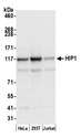 HIP1 Antibody - Detection of human HIP1 by western blot. Samples: Whole cell lysate (50 µg) from HeLa, HEK293T, and Jurkat cells prepared using NETN lysis buffer. Antibody: Affinity purified rabbit anti-HIP1 antibody used for WB at 0.04 µg/ml. Detection: Chemiluminescence with an exposure time of 3 seconds.