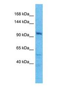 HIP1 Antibody - Western blot of HIP1 Antibody with human A549 Whole Cell lysate.  This image was taken for the unconjugated form of this product. Other forms have not been tested.