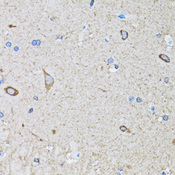 HIP1 Antibody - Immunohistochemistry of paraffin-embedded mouse brain tissue.
