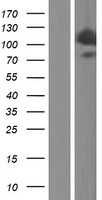HIP1 Protein - Western validation with an anti-DDK antibody * L: Control HEK293 lysate R: Over-expression lysate