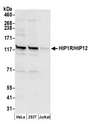 HIP1R Antibody - Detection of human HIP1R/HIP12 by western blot. Samples: Whole cell lysate (50 µg) from HeLa, HEK293T, and Jurkat cells prepared using NETN lysis buffer. Antibody: Affinity purified rabbit anti-HIP1R/HIP12 antibody used for WB at 0.4 µg/ml. Detection: Chemiluminescence with an exposure time of 10 seconds.