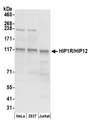 HIP1R Antibody - Detection of human HIP1R/HIP12 by western blot. Samples: Whole cell lysate (50 µg) from HeLa, HEK293T, and Jurkat cells prepared using NETN lysis buffer. Antibody: Affinity purified rabbit anti-HIP1R/HIP12 antibody used for WB at 0.1 µg/ml. Detection: Chemiluminescence with an exposure time of 10 seconds.
