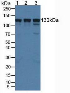 HIP1R Antibody - Western Blot; Sample: Lane1: Porcine Kidney Tissue; Lane2: Human HeLa Cells; Lane3: Porcine Brain Tissue.