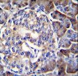 HIP1R Antibody - HIP1R Antibody immunohistochemistry of formalin-fixed and paraffin-embedded human pancreas tissue followed by peroxidase-conjugated secondary antibody and DAB staining.