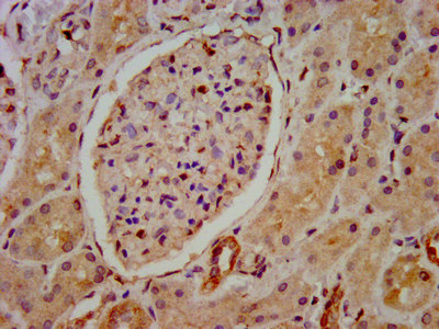 HIP1R Antibody - Immunohistochemistry image at a dilution of 1:800 and staining in paraffin-embedded human kidney tissue performed on a Leica BondTM system. After dewaxing and hydration, antigen retrieval was mediated by high pressure in a citrate buffer (pH 6.0) . Section was blocked with 10% normal goat serum 30min at RT. Then primary antibody (1% BSA) was incubated at 4 °C overnight. The primary is detected by a biotinylated secondary antibody and visualized using an HRP conjugated SP system.