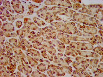 HIP1R Antibody - Immunohistochemistry image at a dilution of 1:800 and staining in paraffin-embedded human pancreatic tissue performed on a Leica BondTM system. After dewaxing and hydration, antigen retrieval was mediated by high pressure in a citrate buffer (pH 6.0) . Section was blocked with 10% normal goat serum 30min at RT. Then primary antibody (1% BSA) was incubated at 4 °C overnight. The primary is detected by a biotinylated secondary antibody and visualized using an HRP conjugated SP system.
